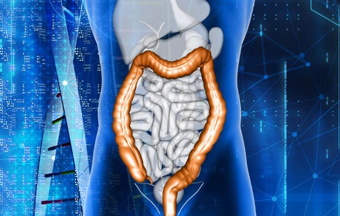 ευερέθιστο έντερο